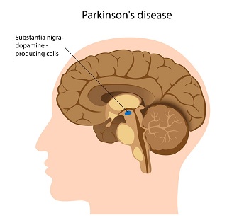 Fig. 1: The location of substantia nigra in the brain (source: parkinsoninfo.org).